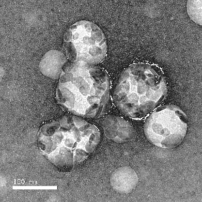 Electron micrograph of nanoparticles